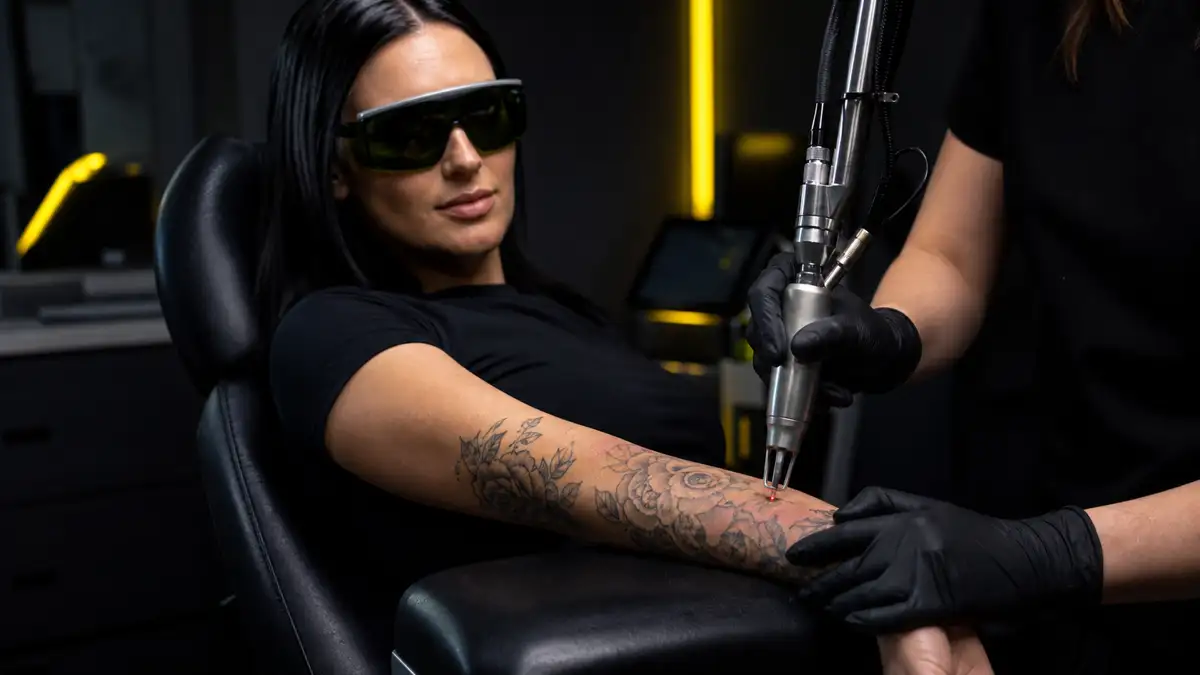 Tatuiruotės šalinimas lazeriu: kaina, skausmas, realybė
